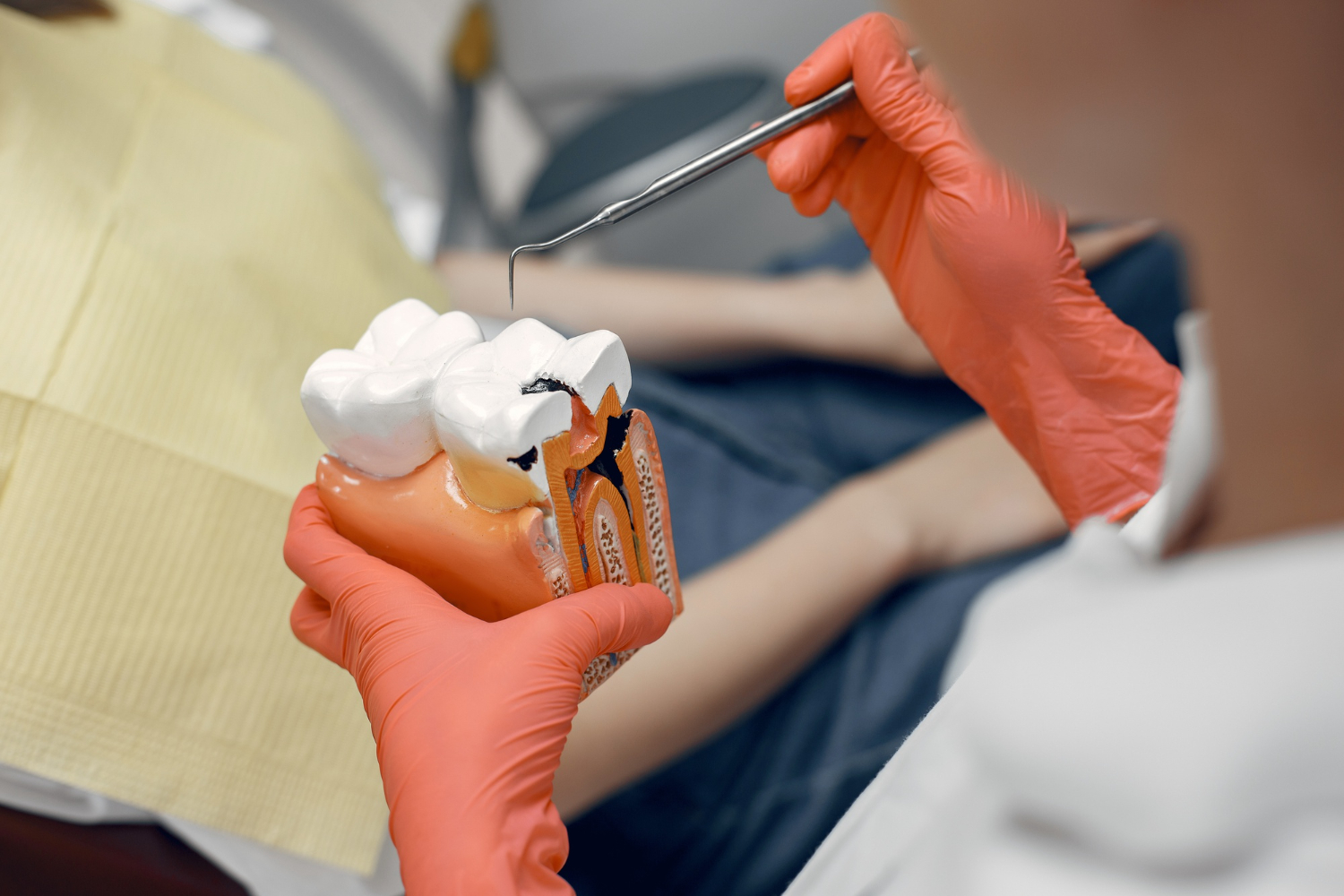 Single and multi-root canal treatments