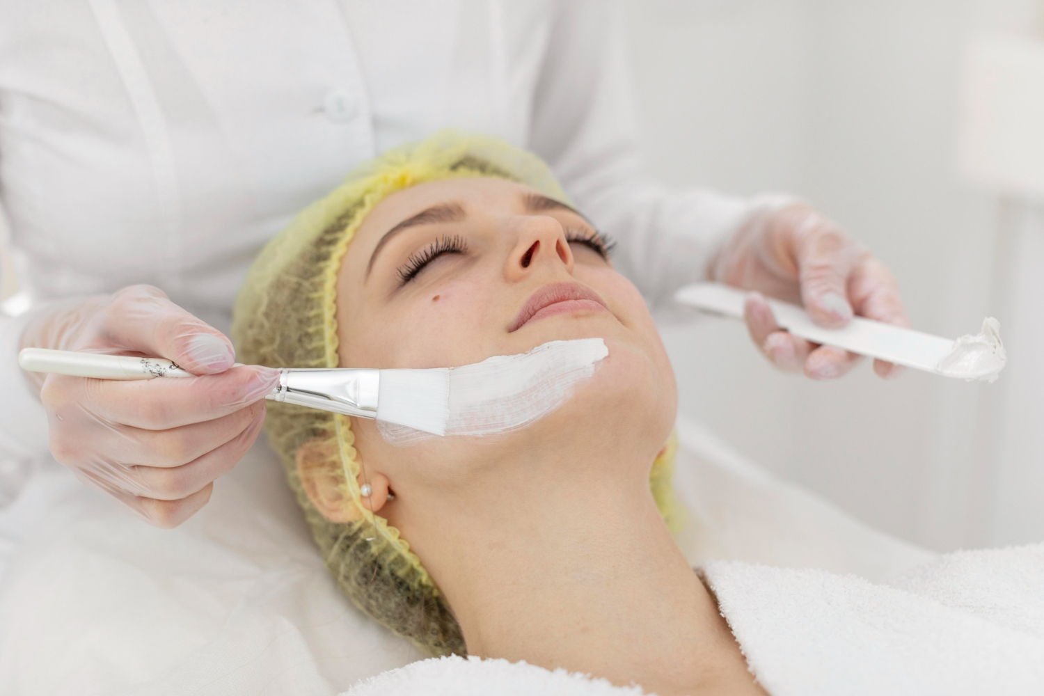 Chemical peels for acne, pigmentation, and overall skin rejuvenation
