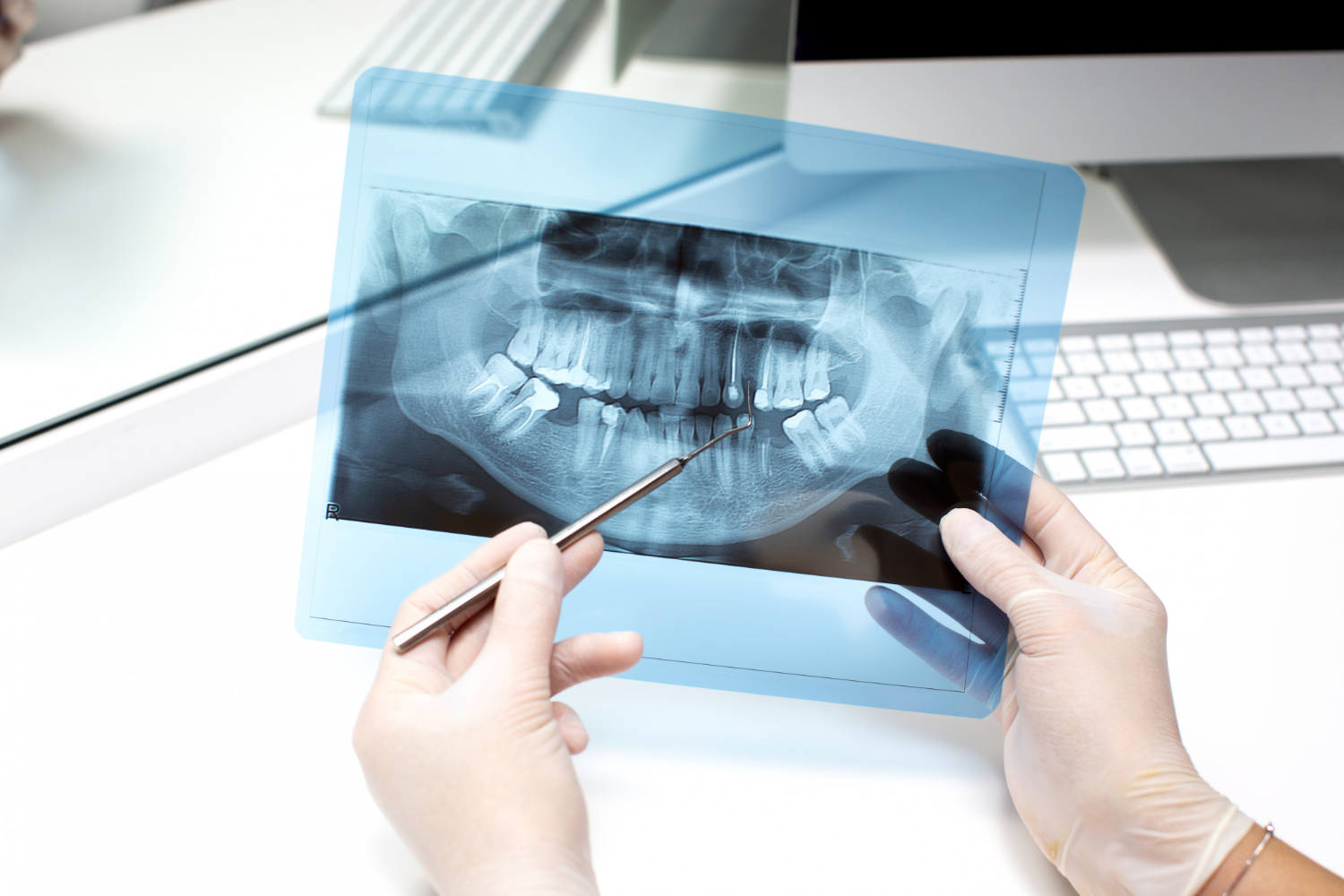 Digital X-rays and diagnostic imaging