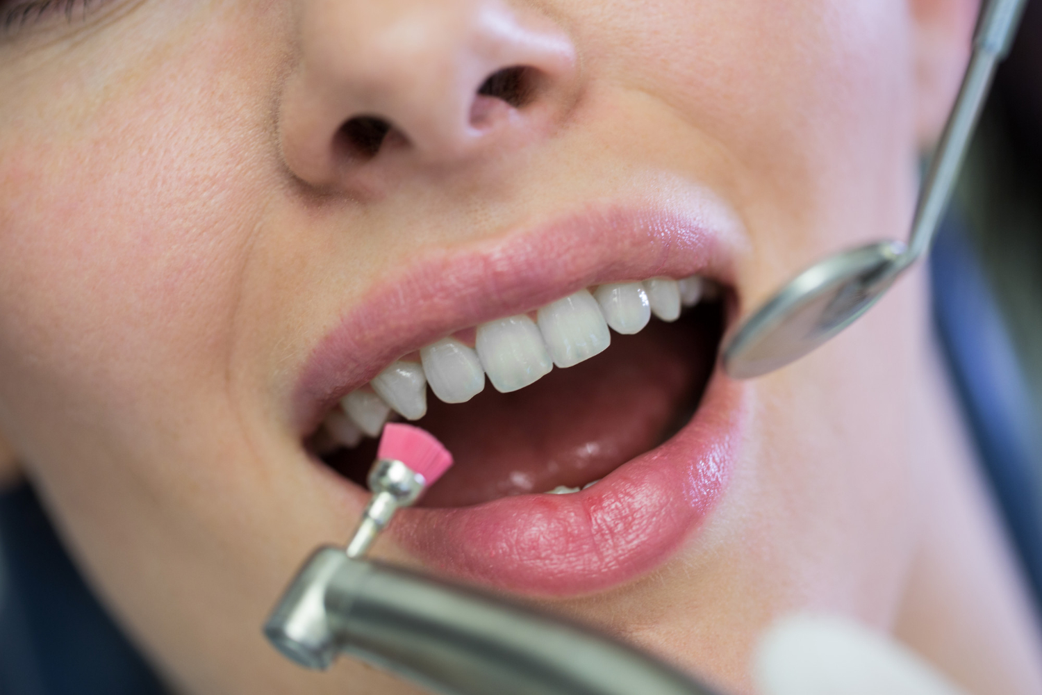 Professional teeth cleaning and polishing