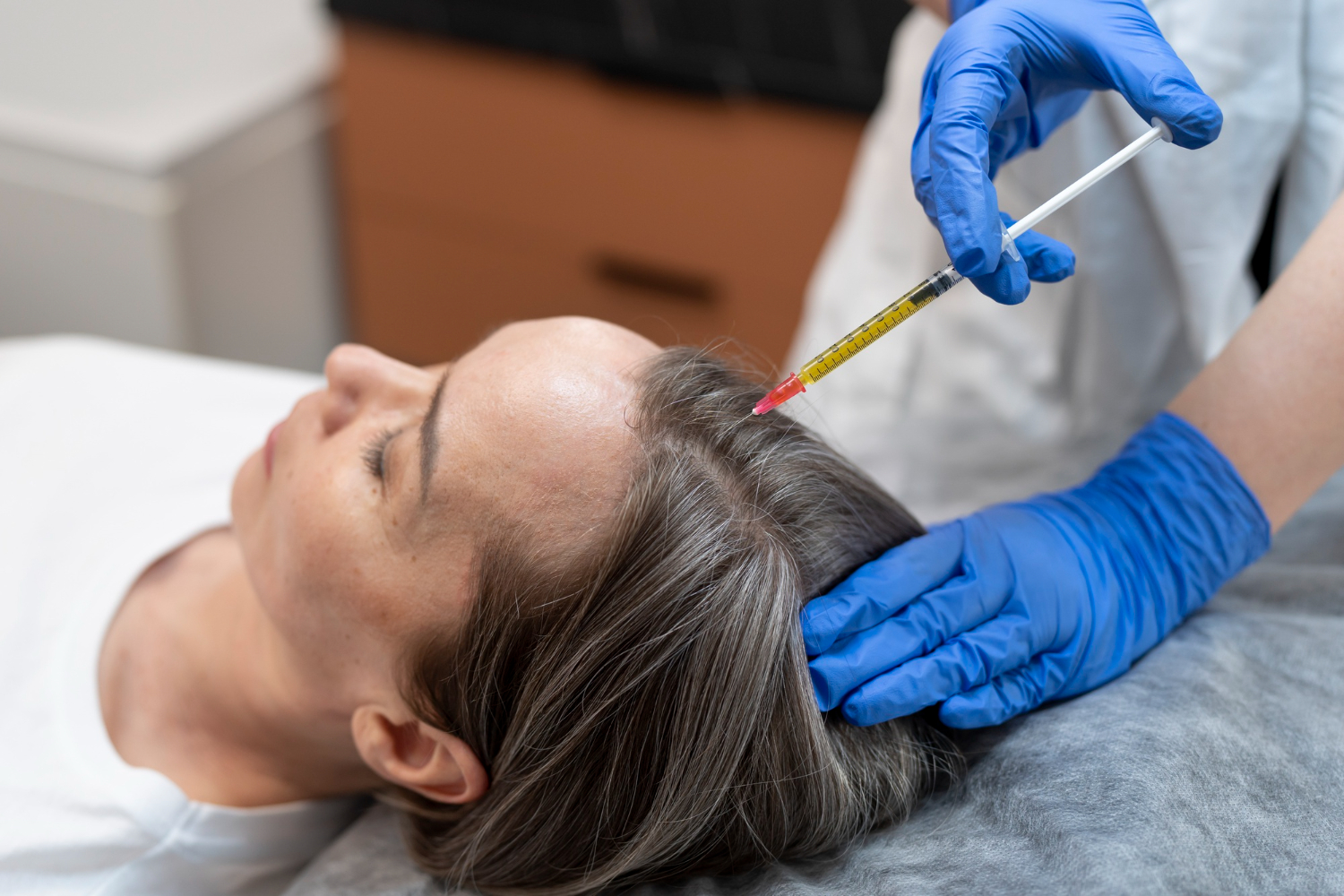 PRP for hair regeneration