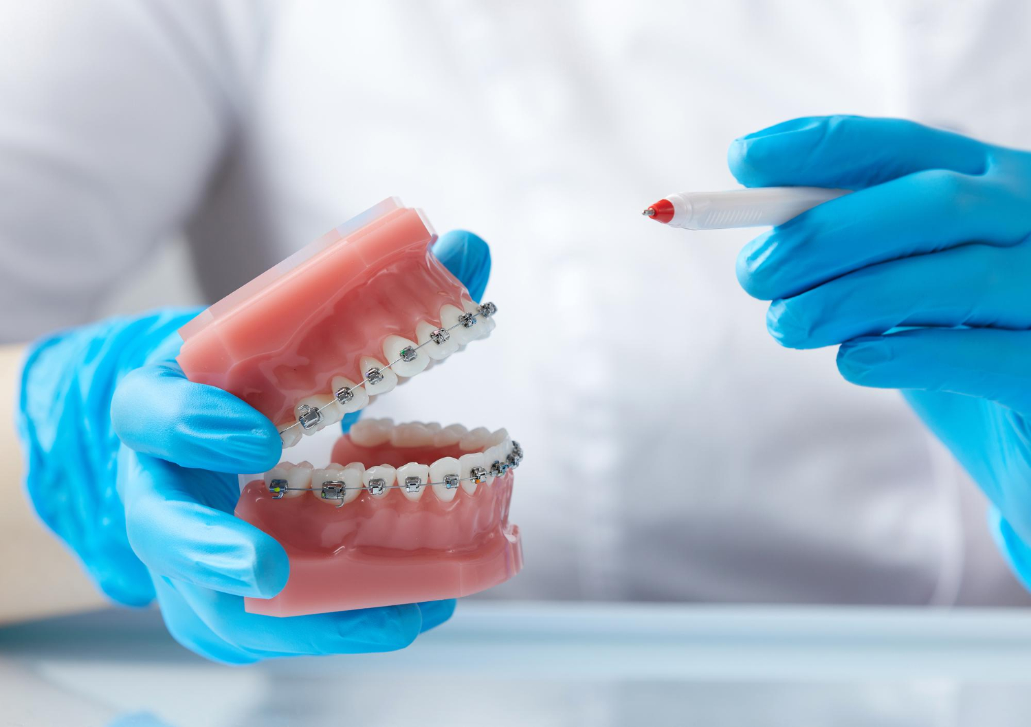 Dental implant placement