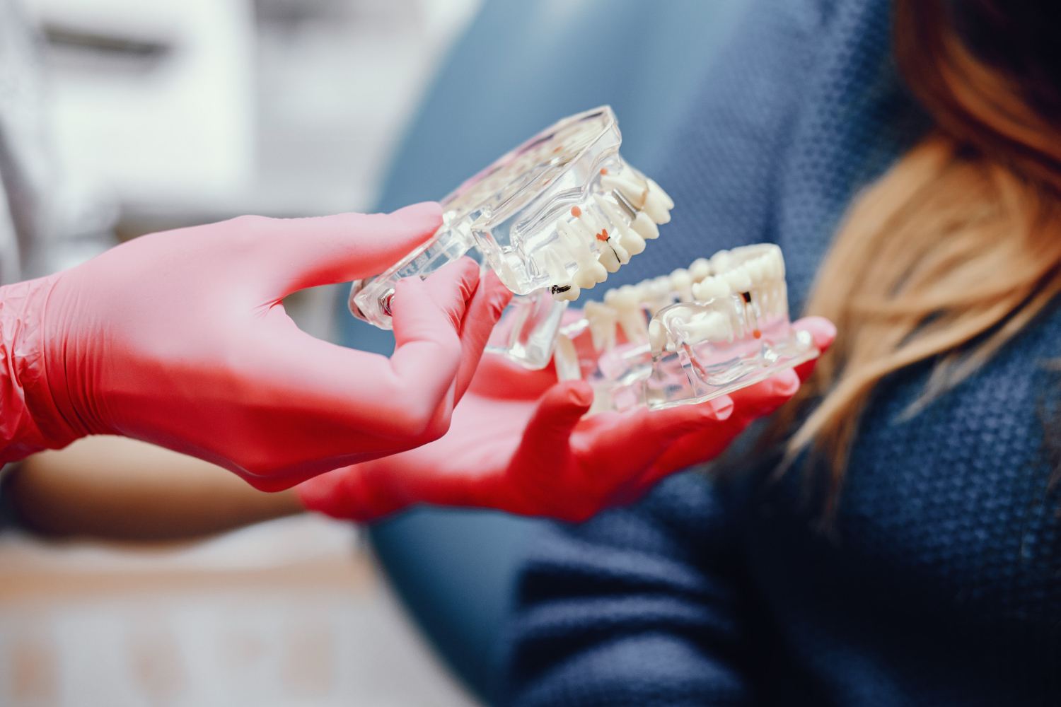 Implant-supported crowns and bridges