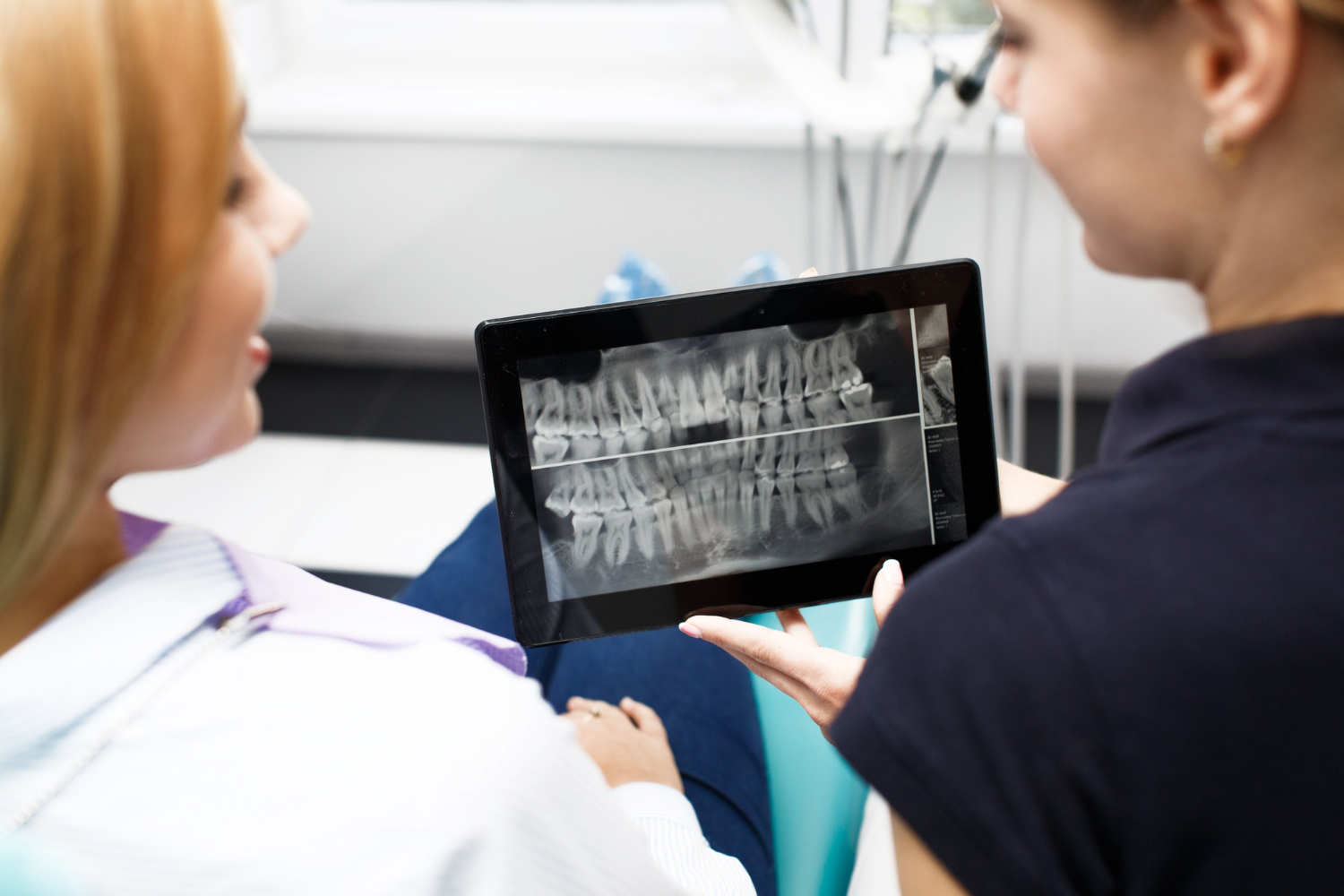 Full-arch implant solutions