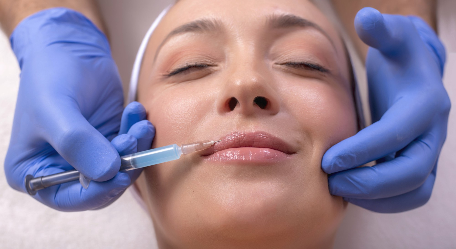 Lip and perioral mesotherapy for fine lines