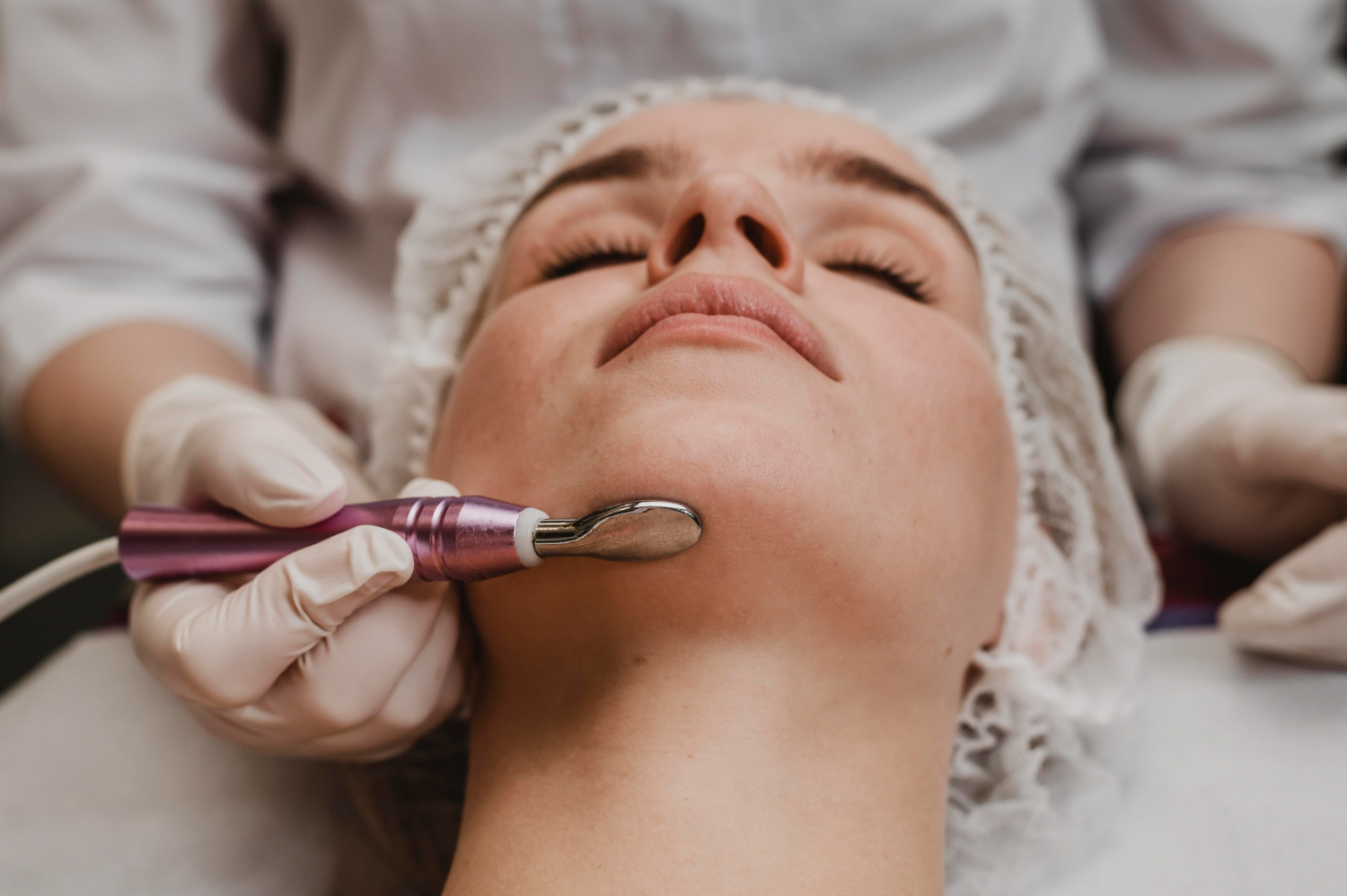 RF (radiofrequency) microneedling for skin tightening and anti-aging